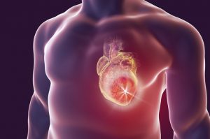 Признаки инфаркта миокарда